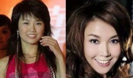 爆料娱乐圈明星整容,揭秘明星变脸真相